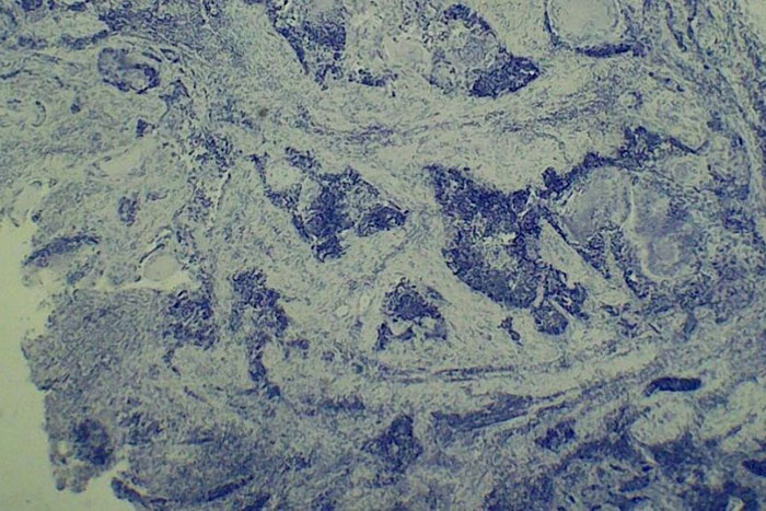 Излучение, ГМО, наследственность: какие мифы о раке вызывают у нас паранойю? Рассказывает онколог